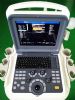 hp-uc600p2 portable 4d color doppler ultrasound system